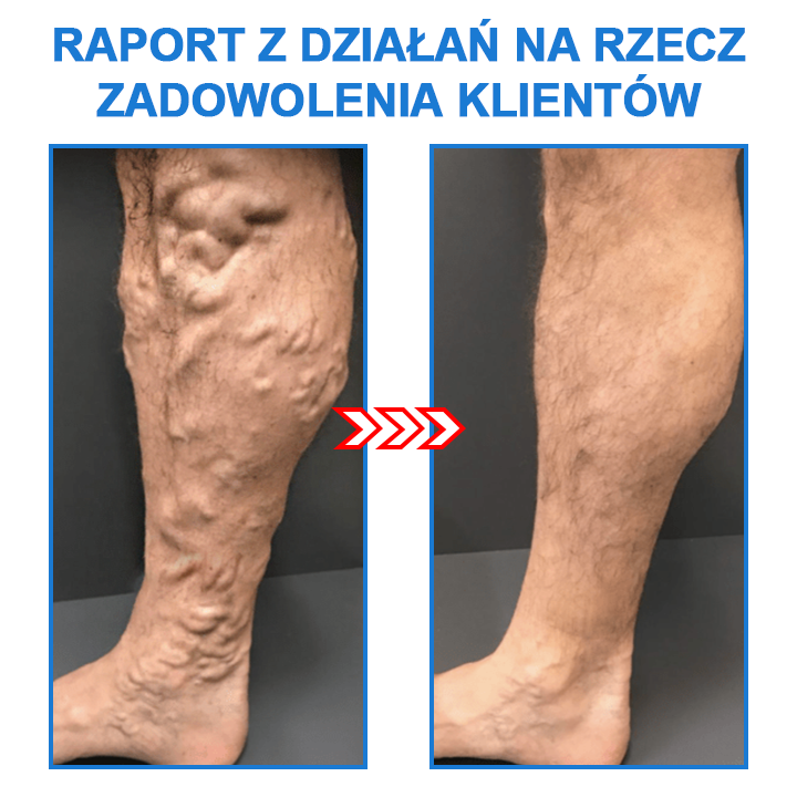 Turmalinowo jonowe skarpetki modelujące do ciała (🔥 oferta ograniczona czasowo, trwa 30 minut)